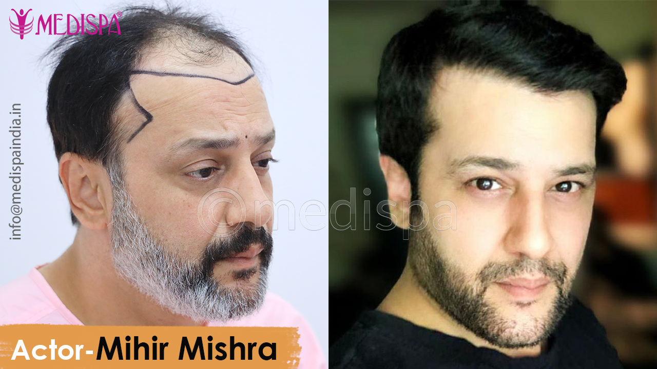 best Celebrity actor Mihir Mishra result