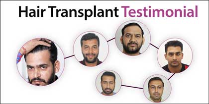 hair transplant india