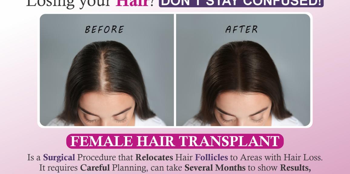 Hair Loss in Women: How Hair Restoration Can Help?