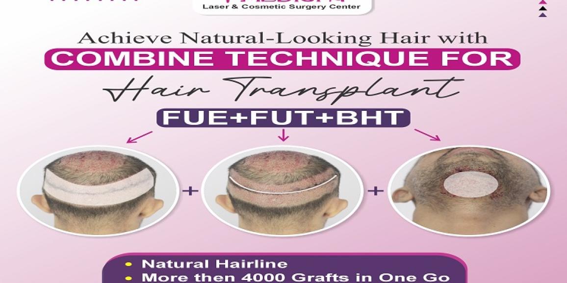 How is FUT+FUE+BHT Hair Transplant Different From Other Methods?