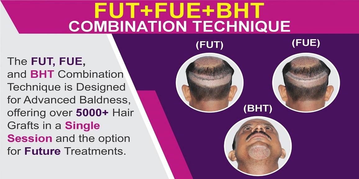 What is FUT+FUE+BHT Hair Transplant Technique?